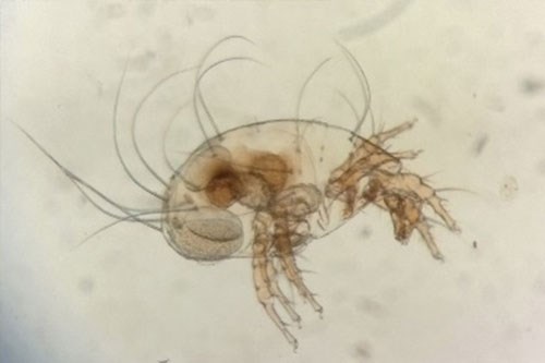 The orabatid mite, intermediate host of the tapeworm